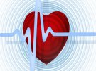 Tanda – Tanda Serangan Jantung Dan Senarai Pakar Kardiologi di Kuala Lumpur