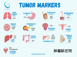 Understanding Tumor Marker Tests: A Comprehensive Overview picture