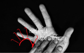 Hand, Wrist & Upper Limb Surgery Mount Alvernia business logo picture